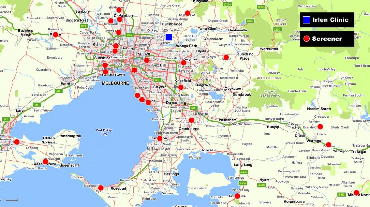 mapa de mayor Melbourne
